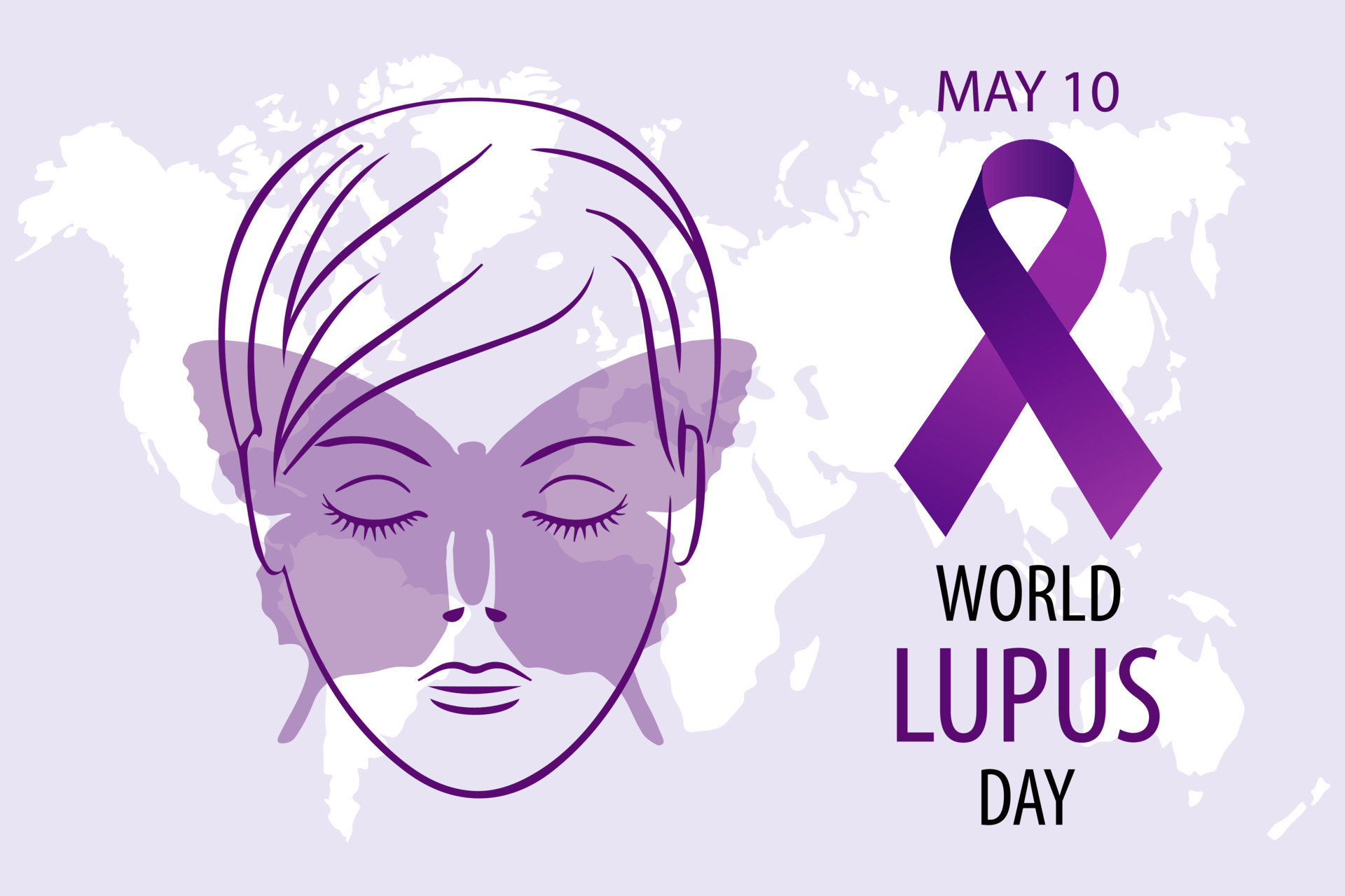 Dossier Pharmaceutique : Lupus Érythémateux Systémique